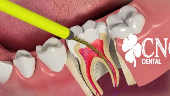 Didim Endodonti Diş Tedavisi