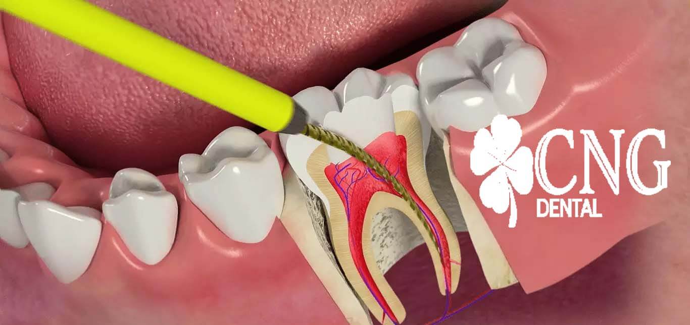 Didim Endodonti Diş Tedavisi