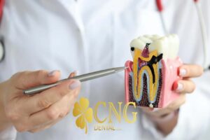 Kuşadası Endodonti Tedavisi